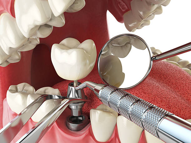 Best Emergency Treatment for Toothache in Quitman, TX